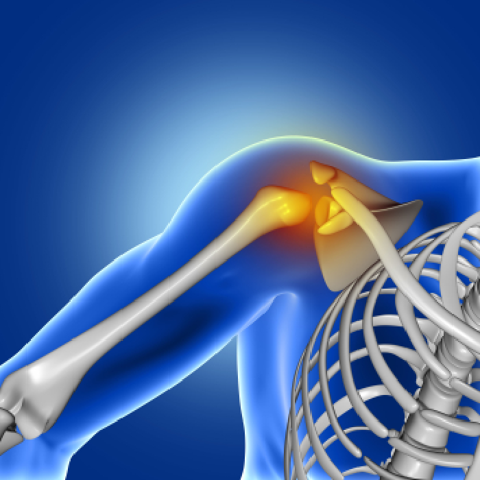 shoulder replacement procedure in pune.